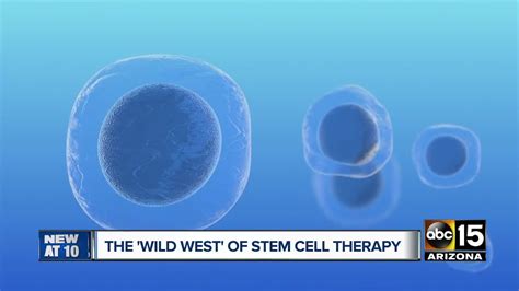 what to know about stem cell therapy in the valley