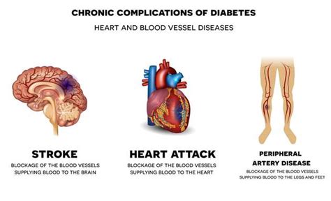 How Diabetes And Heart Attack Are Linked
