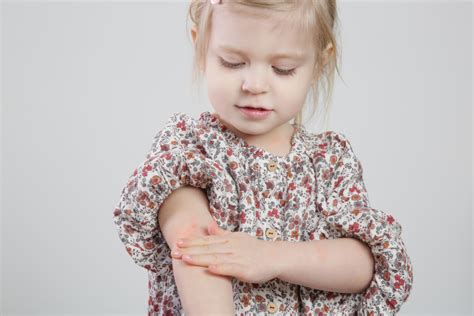Caring For Your Childs Sensitive Skin Pediatricare Of Northern Va Pc
