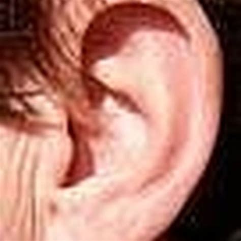 But, popping your ears helps to solve the issue instantly. How to Treat A Popping Ear | Healthy Living