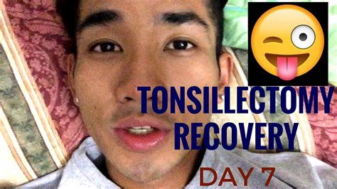 Tonsillectomy Recovery Day 7 Youtube