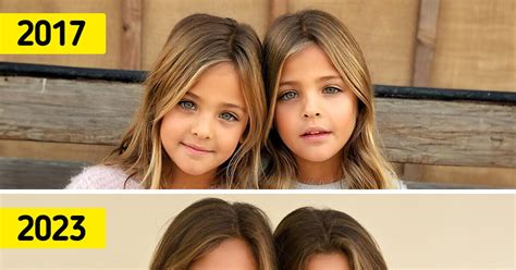 Les plus belles jumelles du monde ont bien grandi et voici à quoi elles ressemblent aujourdhui