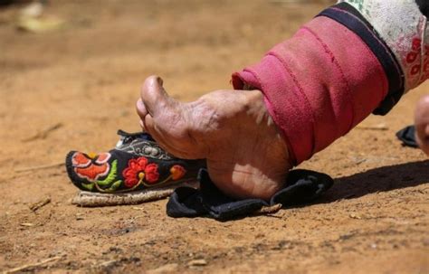 Chinese Women Who Walk With Deformed Feet 10 Pics