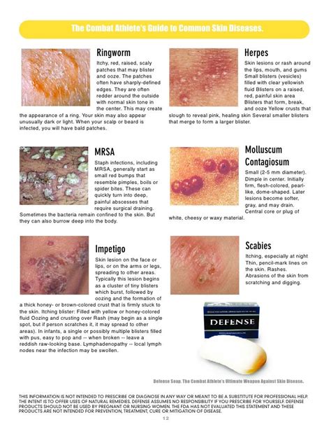 Identify Skin Lesions