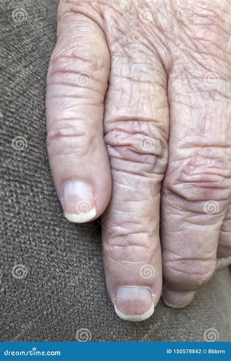 Closeup Wrinkled Hands Of An Old Person Stock Photo Image Of Elderly