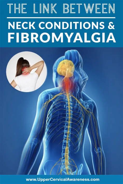 Neck Conditions And Fibromyalgia Upper Cervical Awareness