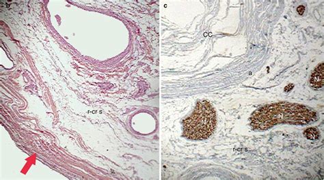 Structure Of The Bulbo Clitoral Organ Anatomic Study Of The Clitoris And The Bulbo Clitoral