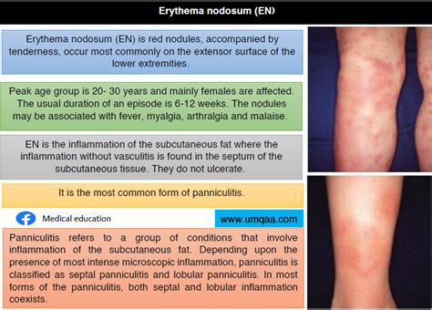 What Are The Causes Of Erythema Nodosum En