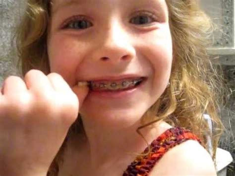 Therefore, you need to seek immediate professional attention while experiencing loose teeth. Loose Tooth - YouTube