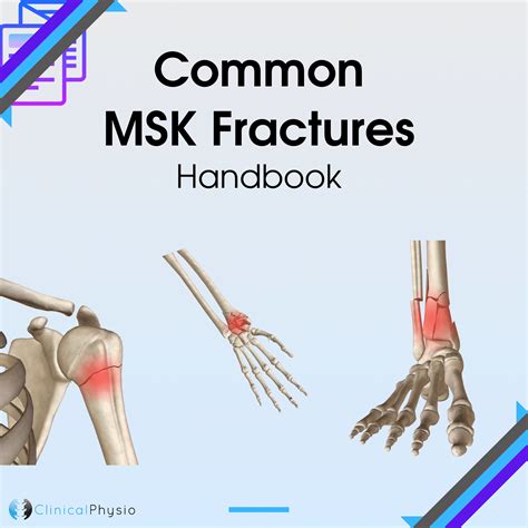 Common Msk Fractures Handbook Clinical Physio