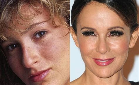 Jennifer Grey’s Before And After Plastic Surgery Effect On Her Stardom Deconstructing The News