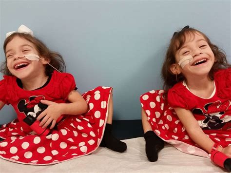 What Life Is Like Now For Formerly Conjoined Twin Sisters After