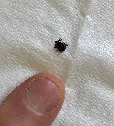 What Type Of Tick Is This Pinky For Size And Found In Central Nj On