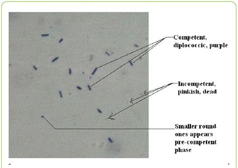 A Stationary Phase Viridans Group Streptococci Diluted 10 000 Fold Download Scientific