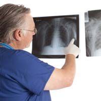 Mesothelioma cancer is an infrequent disease that develops from mutating although thorcoscopies yield the best results for securing a mesothelioma diagnosis, the. Second Surgery May Prolong Mesothelioma Survival ...