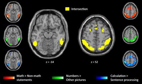 Detectan Regiones Del Cerebro Que Se Activan En Los Matem Ticos