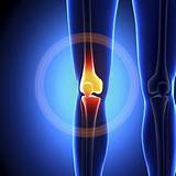 When To See A Doctor For Knee Pain Photos