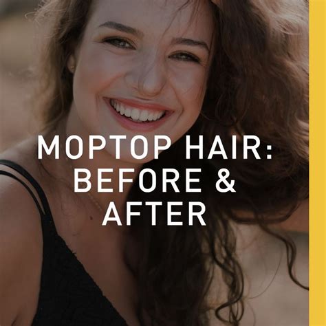 Moptop Hair Before And After Hair Hair Care