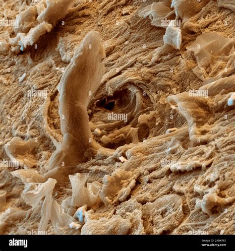 Skin Coloured Scanning Electron Micrograph Sem Of Skin On The Tip Of