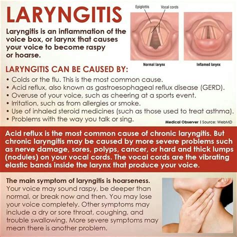 Laryngitis Nursing Study Guide Med Surg Nursing Respiratory Therapy