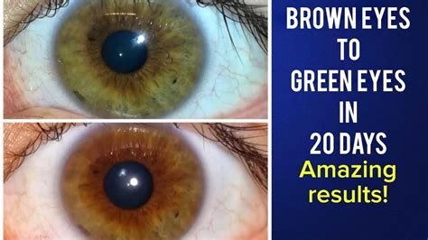Brown Eyes To Green Eyes In 20 Days Using Quadible Integrity Amazing