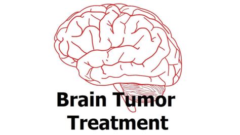 16 Brain Tumor Treatment Medical Therapy And Home Remedies 2022