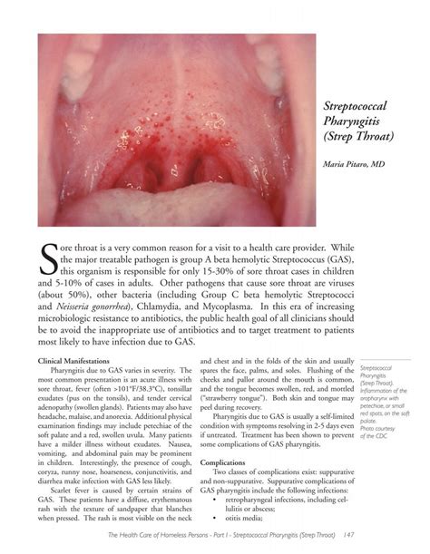 Streptococcal Pharyngitis (Strep Throat) - Boston Health Care for the