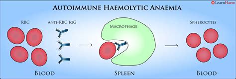 Autoimmune Haemolytic Anaemia Learn Haematology