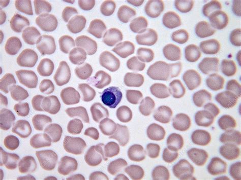 Nucleated Red Blood Cells Lm Stock Image C0435154