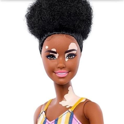 A New Range Of Diverse Barbie Dolls Includes Dolls With Vitiligo And A Prosthetic Limb Bellanaija