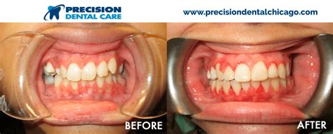 I mean all around excellent customer service. Precision Dental Care | The Best Dentists in Chicago IL