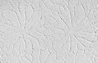 Walls are broken up with windows and doors, and are often decorated with painting, pictures and other decorative items. STIPPLE CEILING PATTERNS | FREE PATTERNS