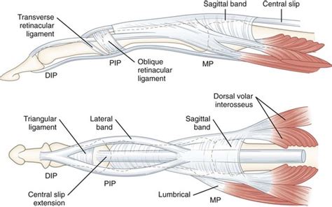 시상대 파열 Sagittal Band Rupture 네이버 블로그