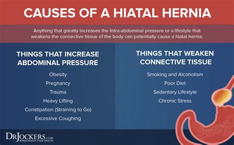 Hiatal Hernia In Women