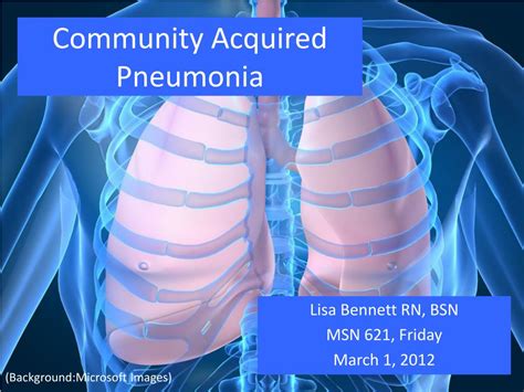 Ppt Community Acquired Pneumonia Powerpoint Presentation Free