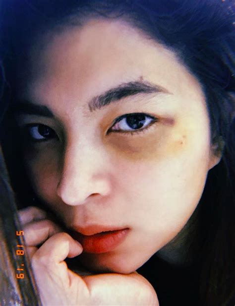 Angel locsin teases kathryn bernardo to get married next. Angel Locsin bares black eye, asks tips for treatment | Inquirer Entertainment