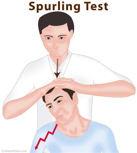 Spurlings Test Mobile Physiotherapy Clinic