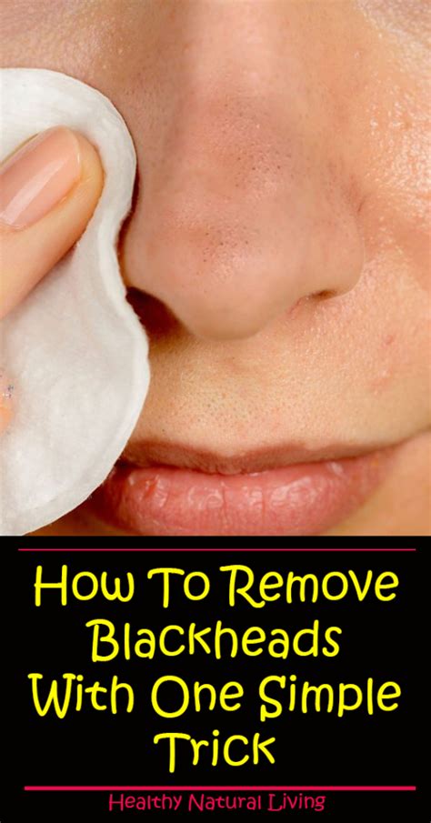 Remove Blackheads With One Simple And Effective Trick Healthy Food Remedy