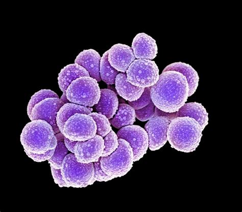 In some cases, it causes pneumonia (lung infection) and other infections. Mrsa Bacteria Photograph by Science Photo Library