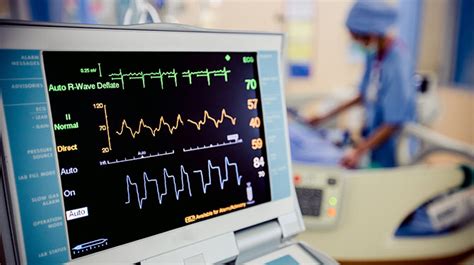 Electrocardiogram Ekg Catholic Health The Right Way To Care