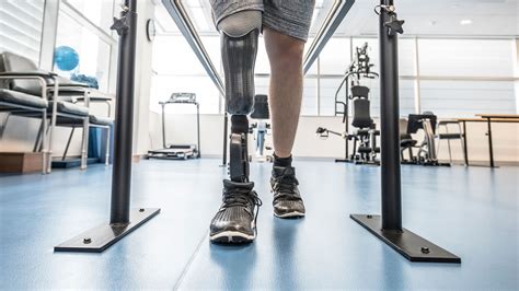 New Way To Prevent Phantom Limb Pain In Amputees