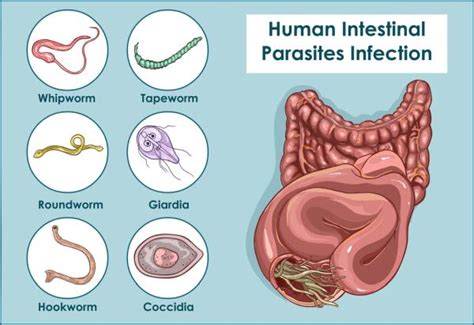 Parasite Symptoms What To Look For Hong Kong Integrative Medical