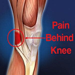 Alibaba.com offers 2,256 knee tendon products. 5 Pain Behind Knee Causes with Relief Tips