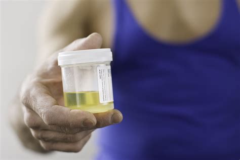 Porphyria Urine Color Giving A Sample What It Means