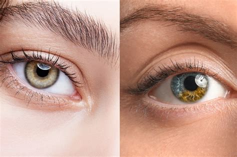 Hazel Eyes Vs Central Heterochromia What S The Difference