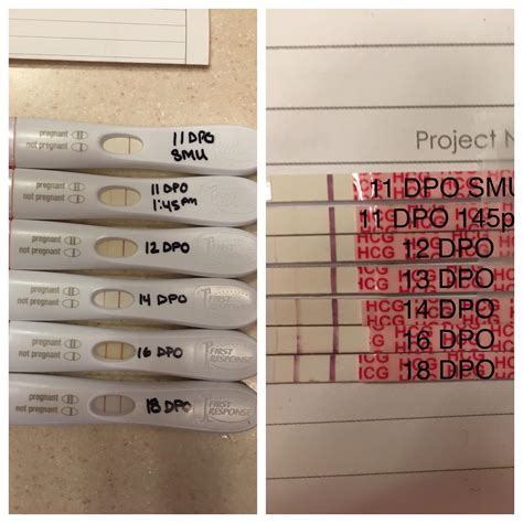293 Best Dpo Wondfo Images On Pholder 1112 Dpo Wondfo And First