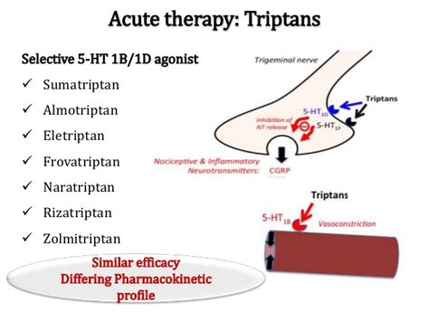 Triptans For Migraine Treatment