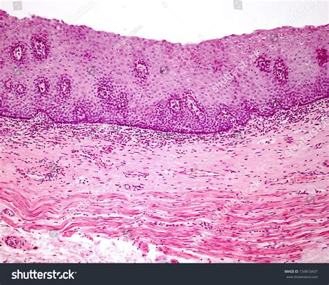 Epithelial Nonkeratinized Stratified Squamous Cell