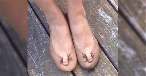 Warning Do Not Look At These Photos If Feet Freak You Out