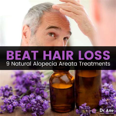 Alopecia Areata 9 Natural Ways To Treat Hair Loss Best Pure